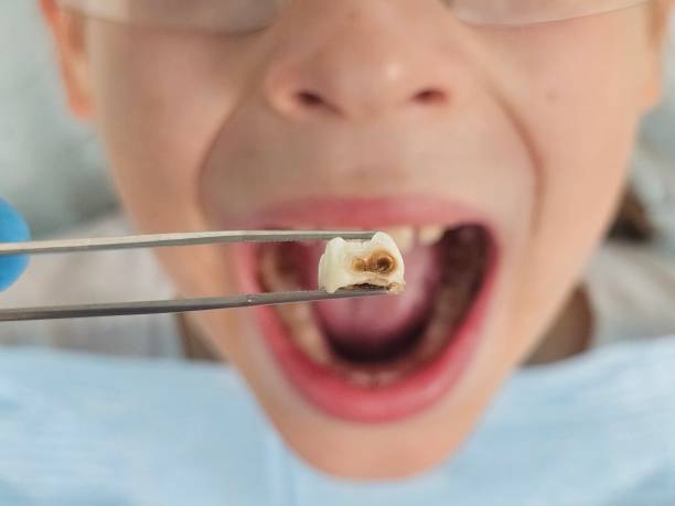 Best Cosmetic Emergency Dentistry in Clinton, MO
