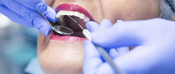 Best Emergency Dental Care for Broken or Chipped Teeth in Clinton, MO